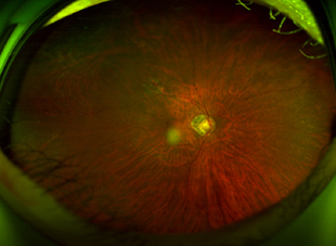 수술 후 10일 사진